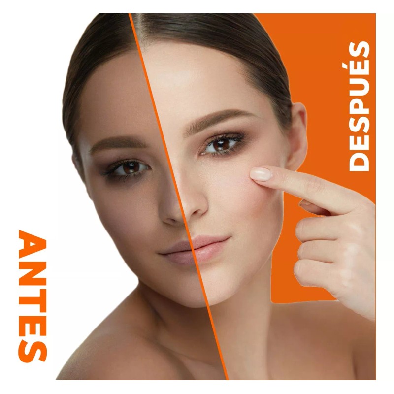 Neoprosone Crema Vitamina C En Gel Neoprosone Despigmentante Aclarante Antimanchas