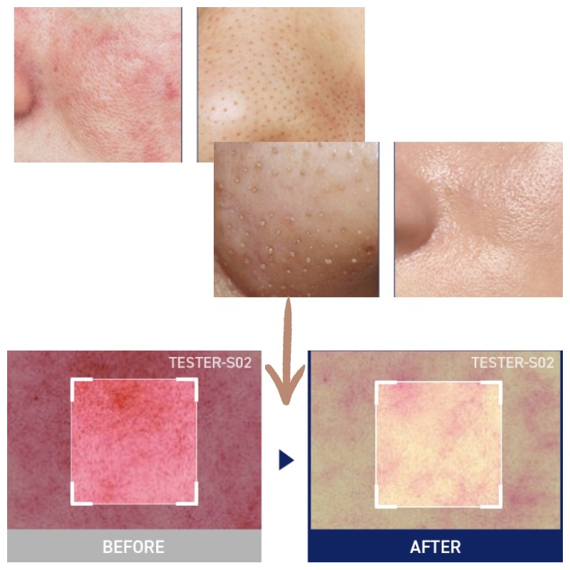 MEDIHEAL Square Toner Pads 200ea, Type:Collagen Ampoule Pad