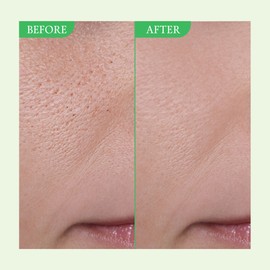 FULLY [FULLY]Green Tomato Serum 30ml