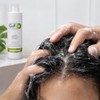 Anti-dandruff shampoo. Shampoo oily hair in a 300 ml bottle.