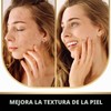 VALITIC Barras de jabón eliminadoras de manchas oscuras de ácido