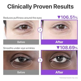 numbuzin Parches Para Ojos N.° 9 | Parches De Colágeno Nad+ Para El Contorno De Ojos | Ojeras, Efecto Refrescante, Reduce La Hinchazón, Arrugas Con Pé