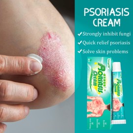 Crema Para Psoriasis Y Eczema, Crema Anti Picazón De Hierbas Chinas Naturales, Para Eczema Para Aliviar La Piel Seca Y Con Picazón, Hidratación A Base De Plantas (Paquete de 1)