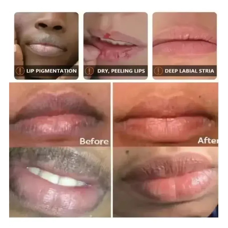 Bálsamo Labial Kormesic Hidratante Reparador 10g