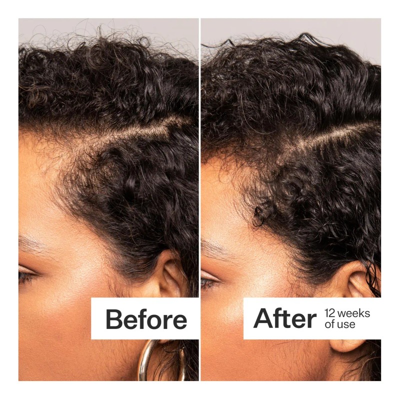 Act+ Acre Cápsulas Para Cabello Grueso Y Fuerte 60 N/a