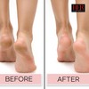 Extreme Callus Remover Gel for Feet and Foot Eliminates Calluses