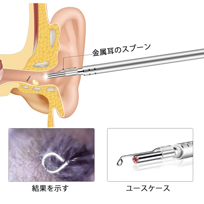 「8本セット」耳スプーン イヤースプーン 耳スコープの先端 交換部品