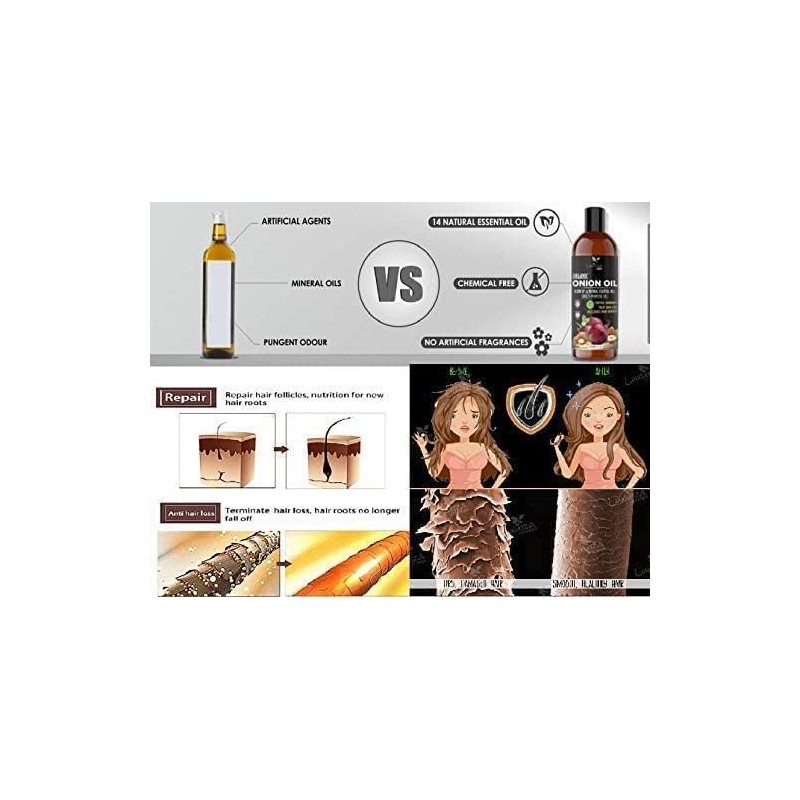 Generic Organic Onion Hair Growth Oil | Controls Hair Loss,