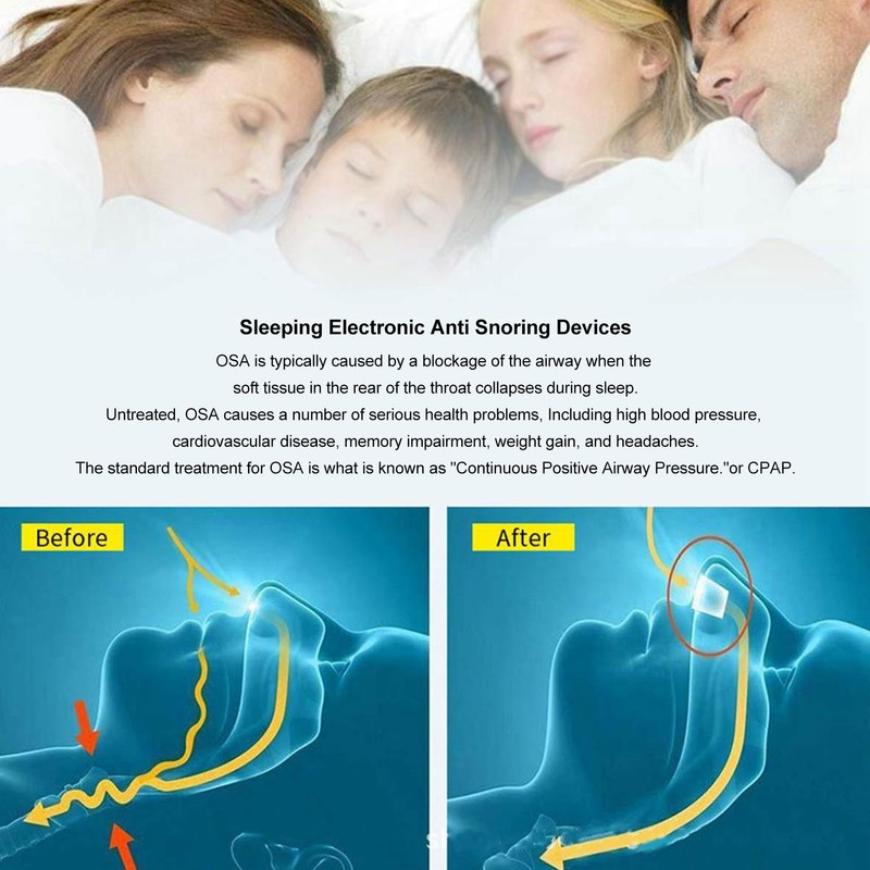 Electric Snoring Solution Devices Automatic Nose Vents Plugs Portable Variable