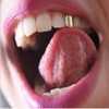 UUYYEO 2 Pcs Single Fangs Plated Gold Hip Hop Top