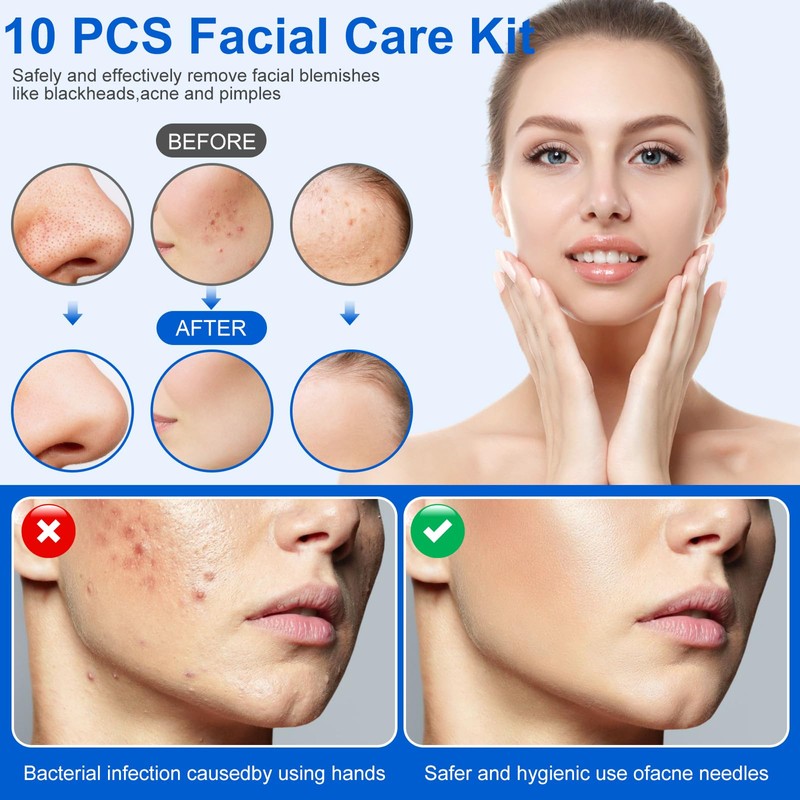 Pimple Popper Tool Kit,10 Pcs Professional Blackhead Remover Comedones Extractor
