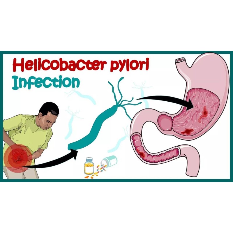 SUPPLEMENTS4ME NATURAL HELP FOR STOMACH BACTERIA - H. PYLORI -