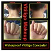 Vitiligo Makeup Cover, Waterproof Cosmetic Concealer for Skin Vitiligo, XISHENGYAN
