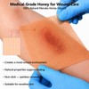 10 Pack Honey Wound Dressing,4'' x 4''Manuka Honey Gauze Dressing,Non-Stick