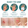 Wound Healing Ointment, Relieve Skin Abrasions, Promote Wound Healing