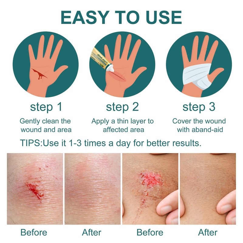 Wound Healing Ointment, Relieve Skin Abrasions, Promote Wound Healing