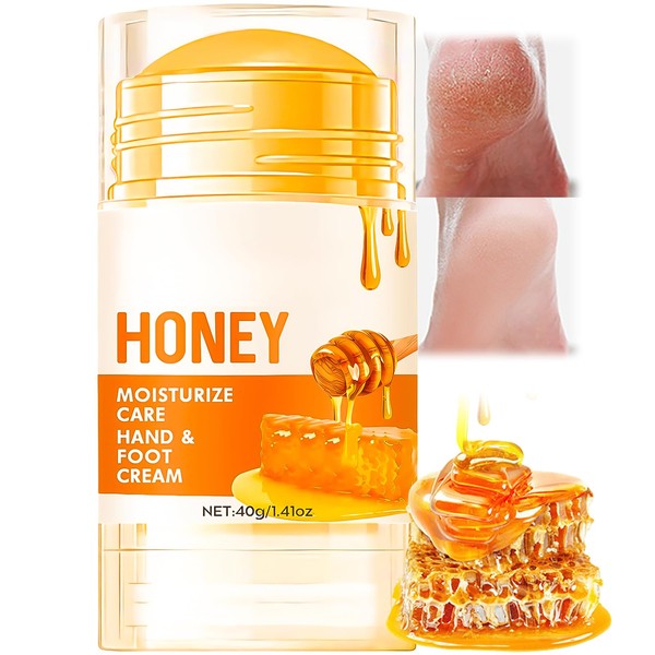 Honey Foot Cream – Moisturizer for Dry Hands & Cracked