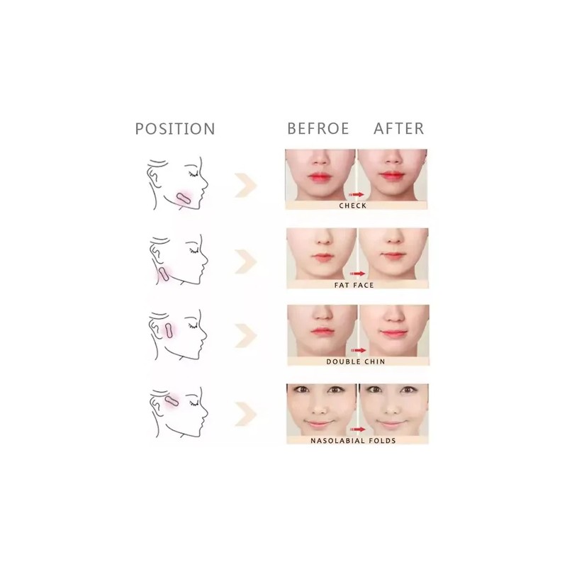 Parche De Estiramiento Facial En Forma De V Transpirable F