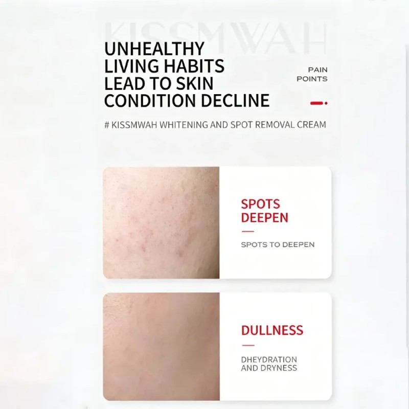 Crema Quitamanchas Hidratante 20g Para Rostro Todo Tipo De Piel