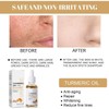 Turmeric Dark Spot Corrector Serum, Natural Turmeric Dark Spot Corrector