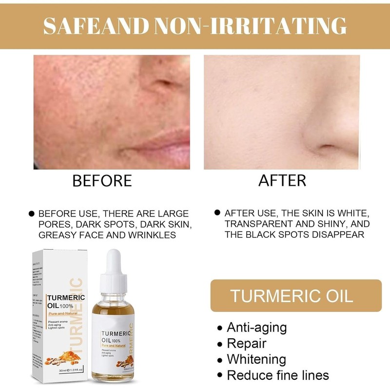 Turmeric Dark Spot Corrector Serum, Natural Turmeric Dark Spot Corrector