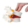 Axis Scientific Human Lumbar Herniating Disc Demonstration Anatomy Model for