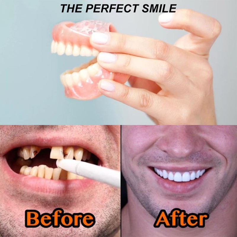 Dentures Set, False Artificial Temporary Teeth Braces Smile Veneers Cosmetic