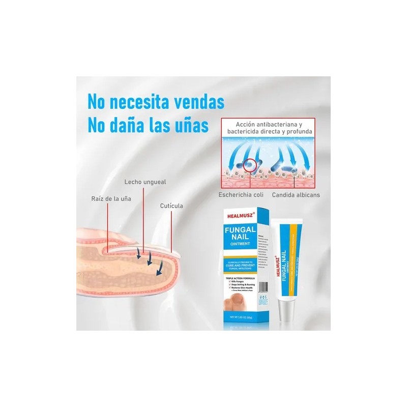 Crema De Uñas Antifúngico Para Uñas De Manos Y Pies
