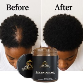 100% Pure Raw Batana Oil – Wildcrafted Honduras | Unrefined, Low-Heat Pressed, 100% Pure