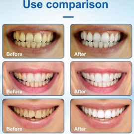 2PCS Whitening Tooth Paint,Teeth Whitening Pen Instant,White/ning Paint for T/eeth,Inst/ant WHI/tening P/Aint for Teet/h,Instant Tee/th W/hitening Essence Gel,Te/ETH Wh/itening Pen