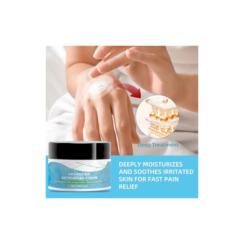 Antifungal Cream, Fast Soothing Itchy, Gentle and Safe (2 Pack)