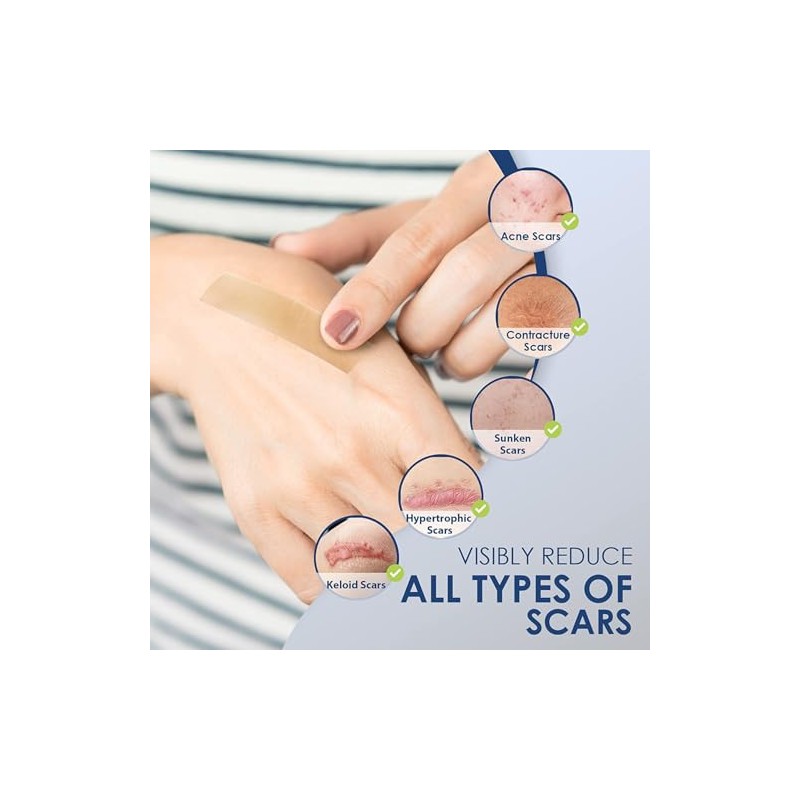 Admirada Silicone Sheets for Scars: Reusable Scar Care Tape for