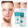 Crema Correctora Facial Manchas Acné Paño Puntos Negros