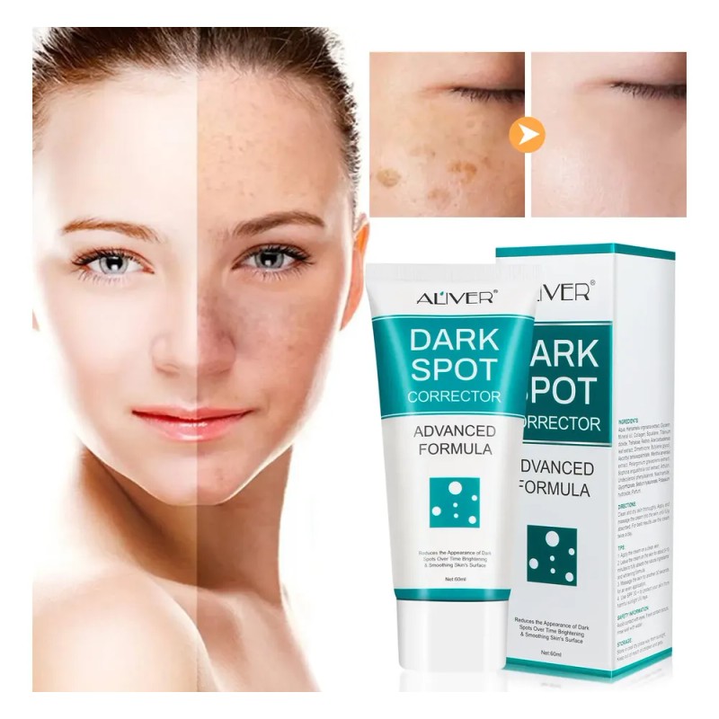 Crema Correctora Facial Manchas Acné Paño Puntos Negros