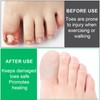 STSTR 10 PCS Soft Gel Toe Caps, Elastic Toe Protectors