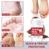 Cracked Heel Balm With Coconut Oil - Foot Cream For