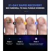 LOZLTX New Nagepilz Laser mit Zeitmessgerät Nagelpilz Lasrgeät【21Tage schnell wirkende】【3