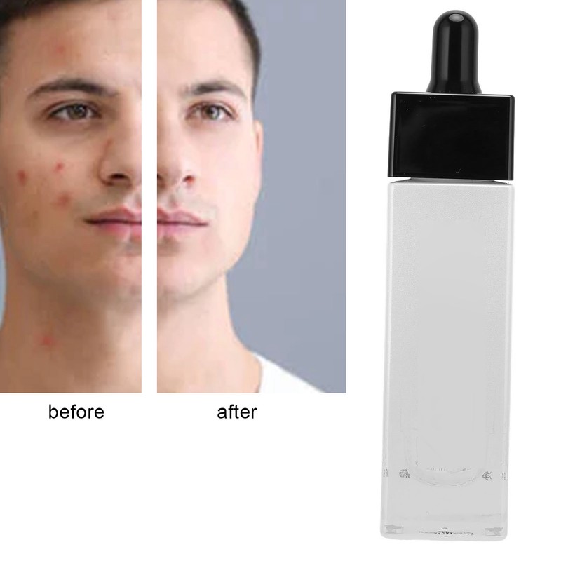 30ml Face Serum Anti Freckle Moisturizing Brightening Serum Fade Acne