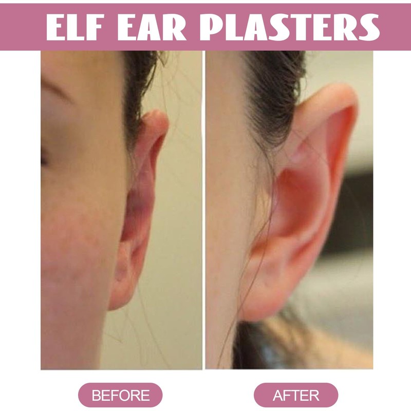 30pcs Cosmetic Ear Corrector,Ear Pinning Stickers,Ear Protection Sticker,Ear Stickers Correctors,Solve