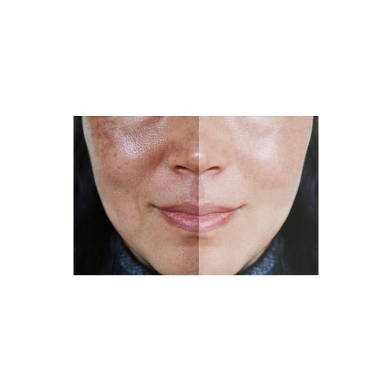 Vitality Precision Skin Phloretin C Serum