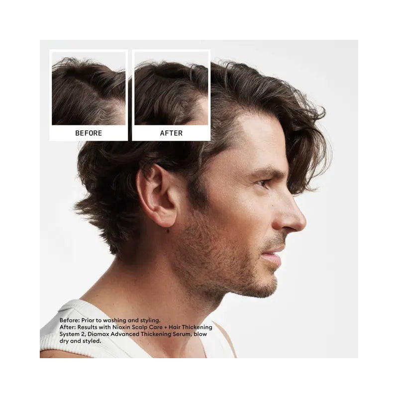 Nioxin Scalp + Hair Thickening System 2 Full Size Kit