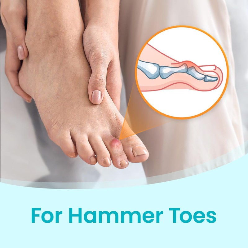 Pozpo Tech Hammer Toe Straighteners Toe Correction Splint for Women