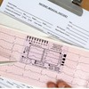 Transparent ECG ruler Transparently EKG Pocket Card Measuring Tool Pocket