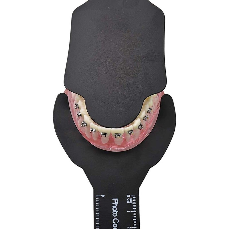 6Pcs Photography Contraster,6 Size Black Background Board Photographic,Oral Cheek Retractors