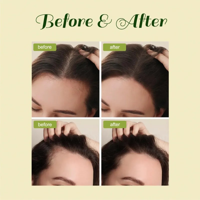 Aceite Para El Crecimiento Del Cabello