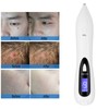 Professional Spot Tattoo Freckle Removal Machine No Bleeding Mole Dot