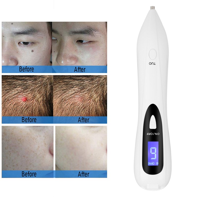 Professional Spot Tattoo Freckle Removal Machine No Bleeding Mole Dot