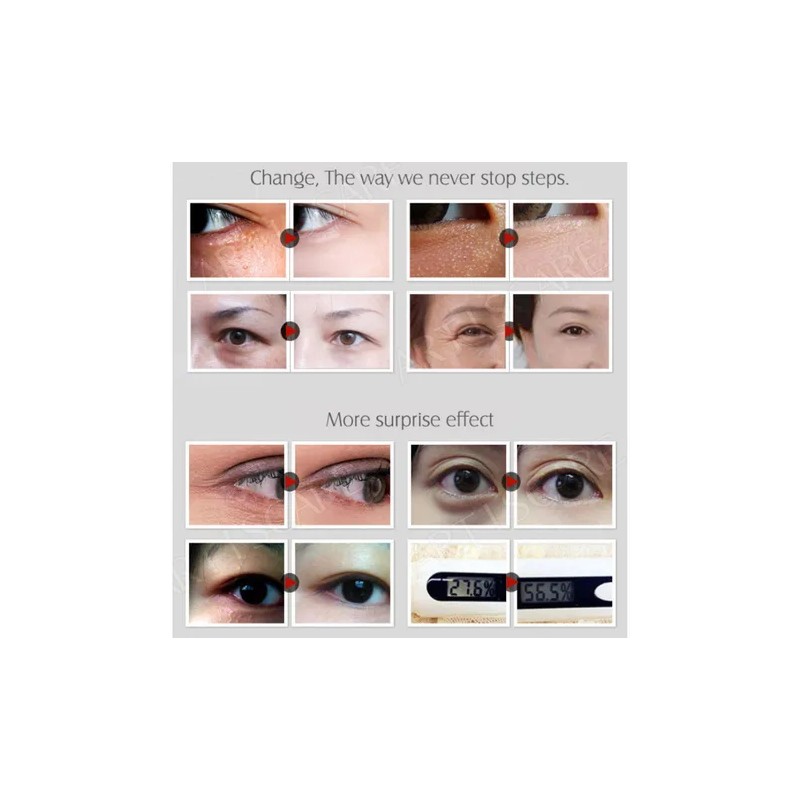 D Coenzima Q10: Control De Aceite Hidratante Para El Envejec