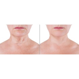 Age Defying Ceramide Cream to Boost COLLAGEN | Restore Skin’s Elasticity &Strength | Exfoliates, Brighten & Hydrates Skin | Organic & Natural Ingredients