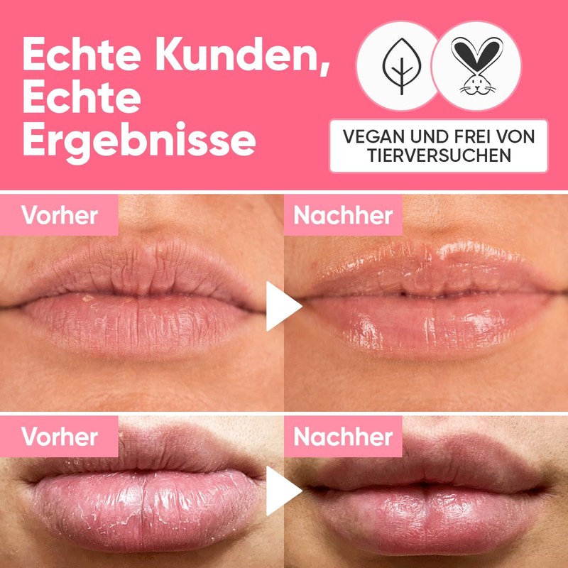 Berry Smooth Lip Balm - Intensive Moisturiser with Natural Pink